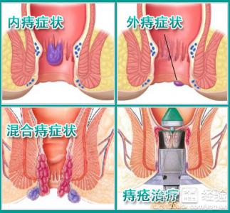 第1步